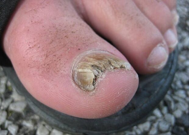 Az elhanyagolás eredménye