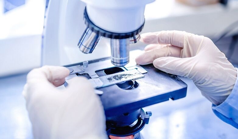 körömgomba laboratóriumi diagnosztikája