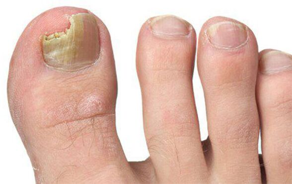 A gomba különféle formái