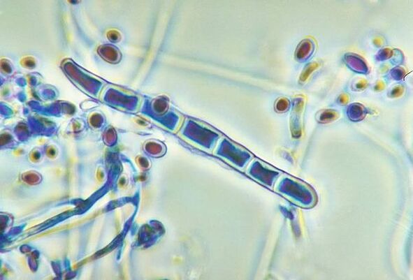 Trichophyton rubrum gomba mikroszkóp alatt