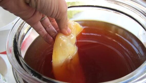 Kombucha körömgomba kezelésére